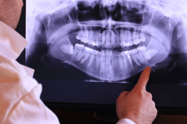 Best Emergency Dentist for Special Needs Patients in Watergate, FL