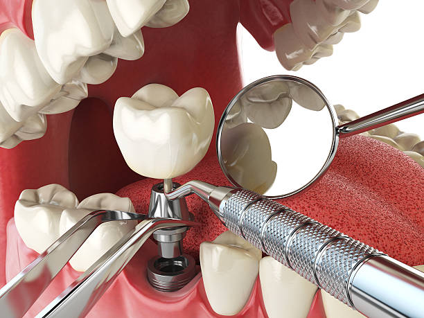 Best Mobile Emergency Dentist in Watergate, FL